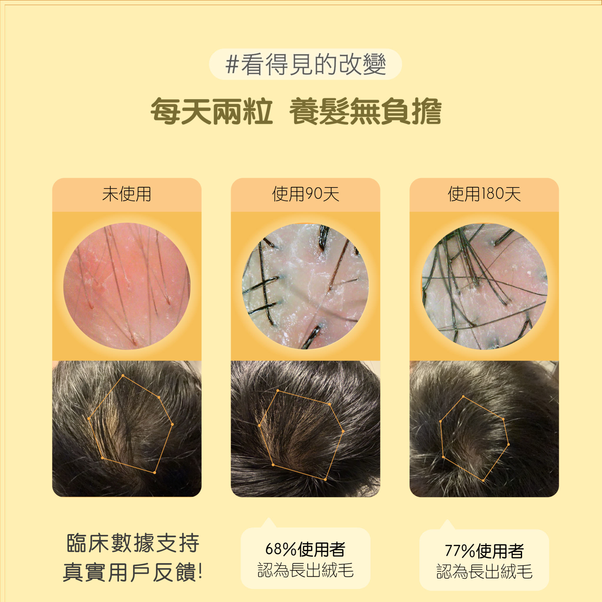 Hair Vitamin Gummies 爆髮維他命軟糖